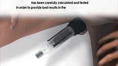 how to use penis enlagement machine.MP4 Call- 9883788091
